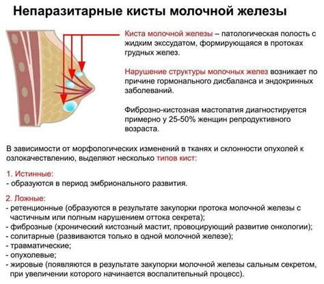 Шишка в груди при ГВ: причины и рекомендации