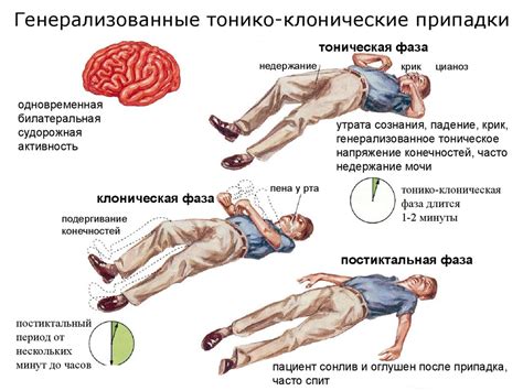 Эпилепсия: симптомы, причины, лечение