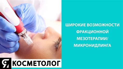 Эффективность микронидлинга и фракционной мезотерапии: сравнение результатов