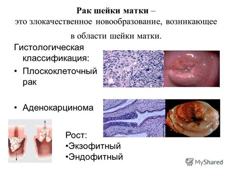  Популярные тематики рисунков на области шейки
