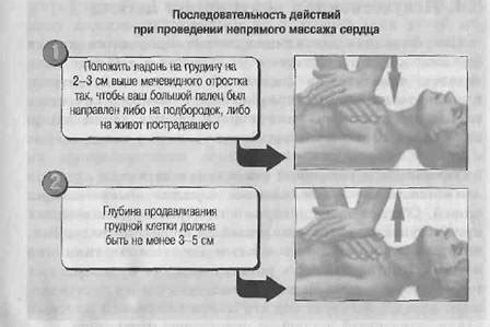  Потенциальные опасности при нанесении удара по грудине 