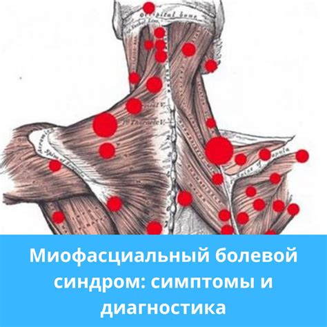  Ухудшение подвижности и болевой синдром 