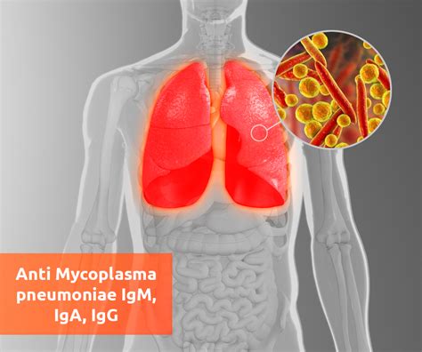 Mycoplasma pneumoniae IgA: значимость и особенности у детей